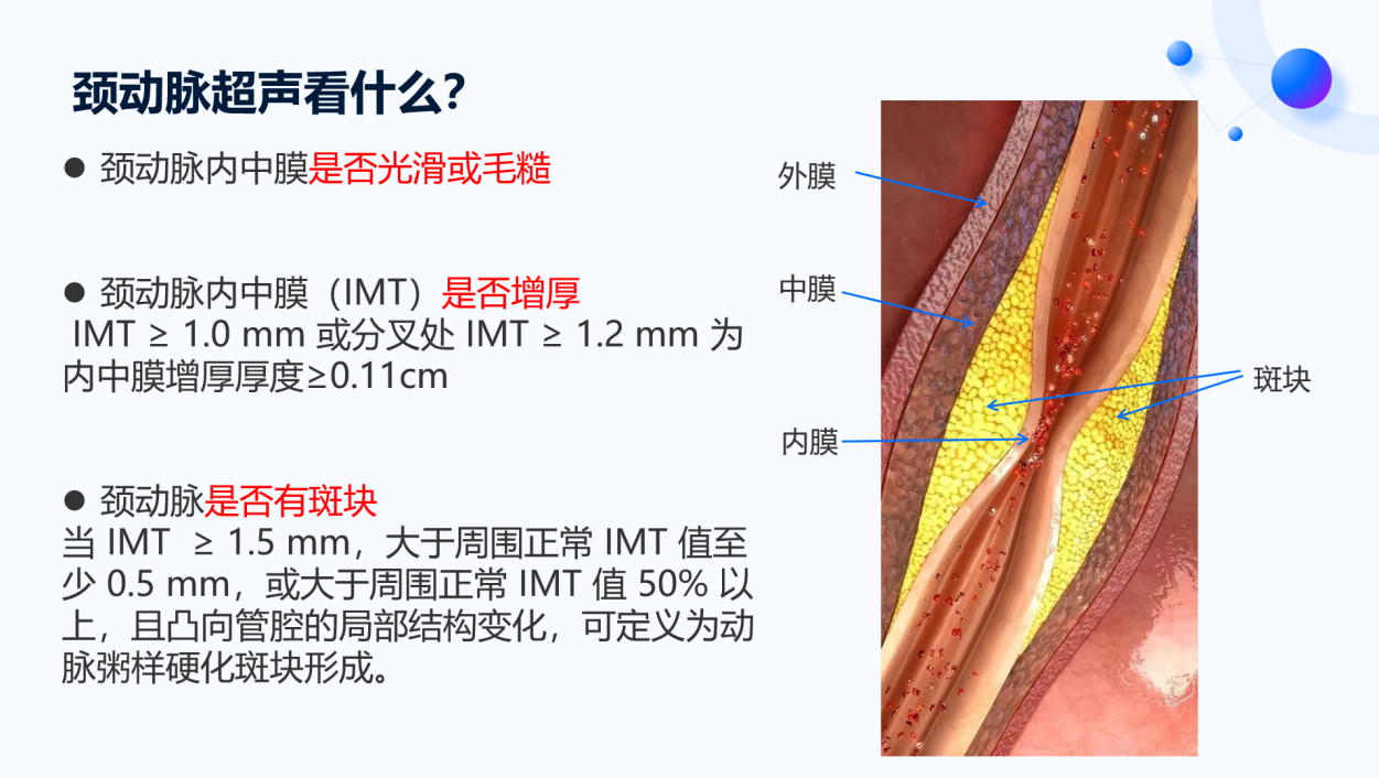 如何判断动脉斑块是否改善？