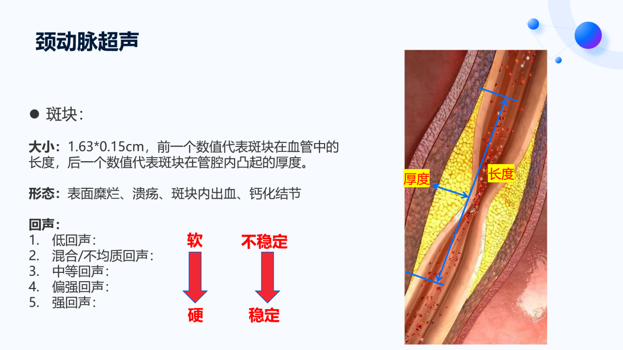 如何判断动脉斑块是否改善？