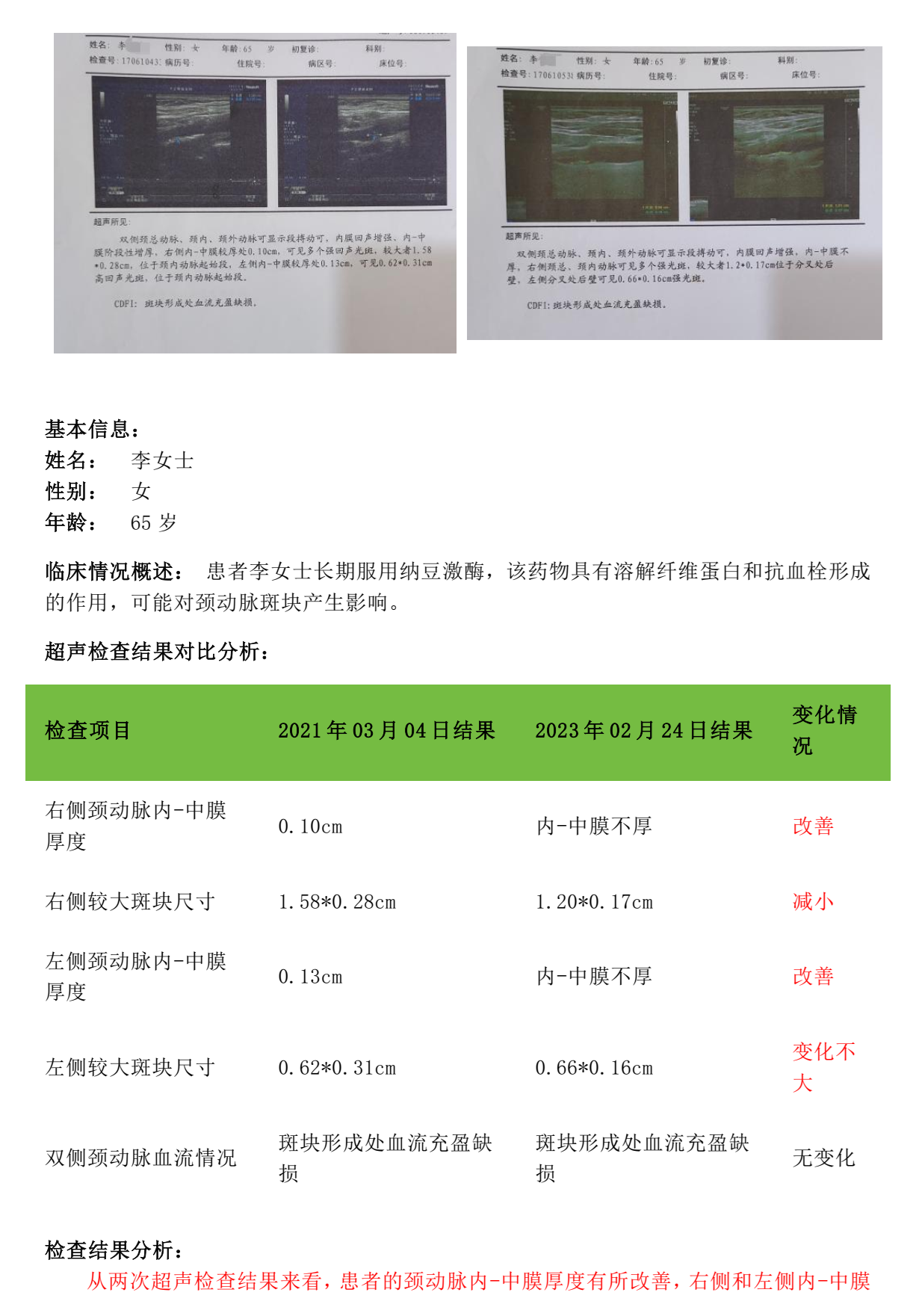 客户案例分析报告（李女士斑块改善）